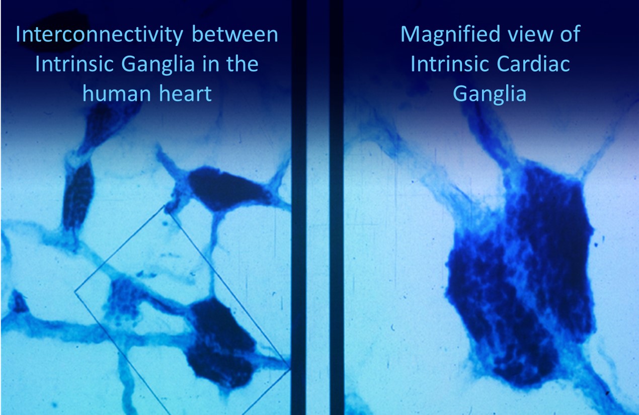 Intrinsic cardiac ganglia